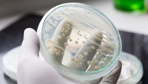 研究發現常見的紙貼紙或許能取代傳統採樣拭子成為監測有害微生物的材料